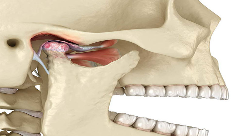 آناتومی مفصل TMJ