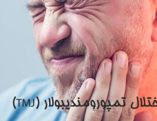 اختلال تمپورومندیبولار (TMJ)